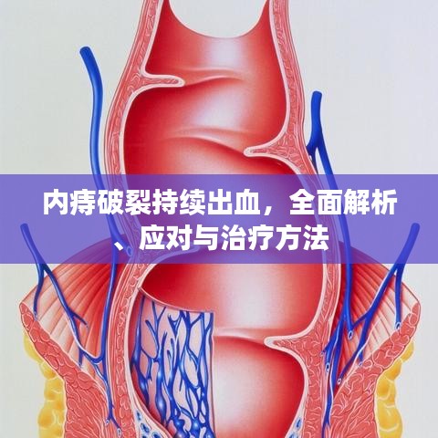 內(nèi)痔破裂持續(xù)出血，全面解析、應(yīng)對與治療方法