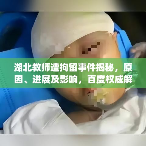 湖北教師遭拘留事件揭秘，原因、進(jìn)展及影響，百度權(quán)威解讀！