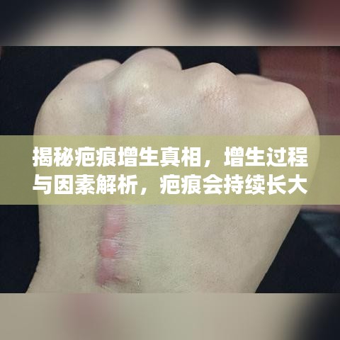 揭秘疤痕增生真相，增生過程與因素解析，疤痕會持續(xù)長大嗎？