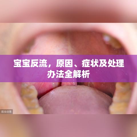 寶寶反流，原因、癥狀及處理辦法全解析