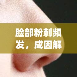 臉部粉刺頻發(fā)，成因解析與防治管理策略