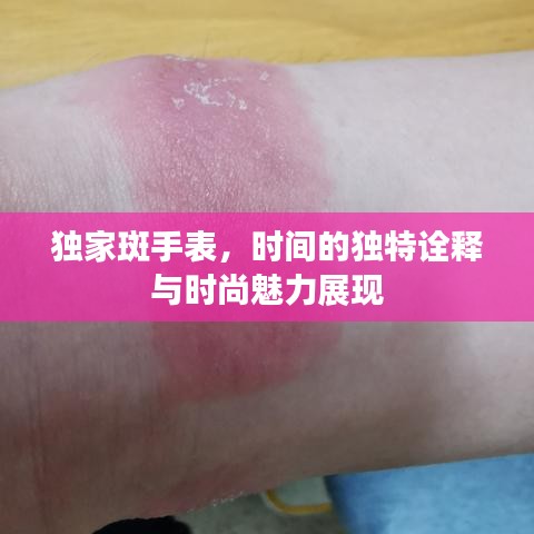 獨(dú)家斑手表，時(shí)間的獨(dú)特詮釋與時(shí)尚魅力展現(xiàn)